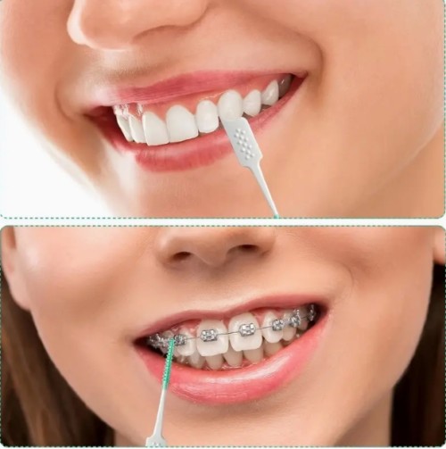 400팩 미니 플로스 브러시, 민트 향 치과용 치실, 소프트 인터덴탈 클리닝 브러시, 포름알데히드 프리 구강 관리용 이빨과 잇몸